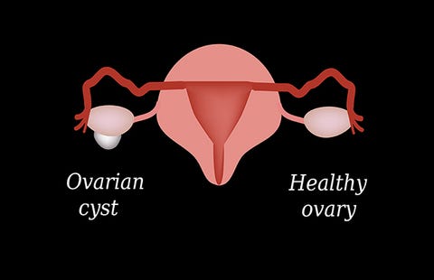 Do you lose weight from having your gallbladder removed image 1