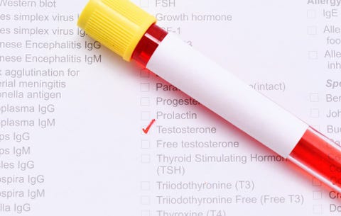 Testosterone levels Testosterone levels