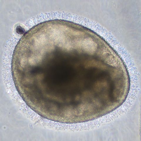 microscopic images of the retinal organoids with hairlike structures on the outer segments on the surface