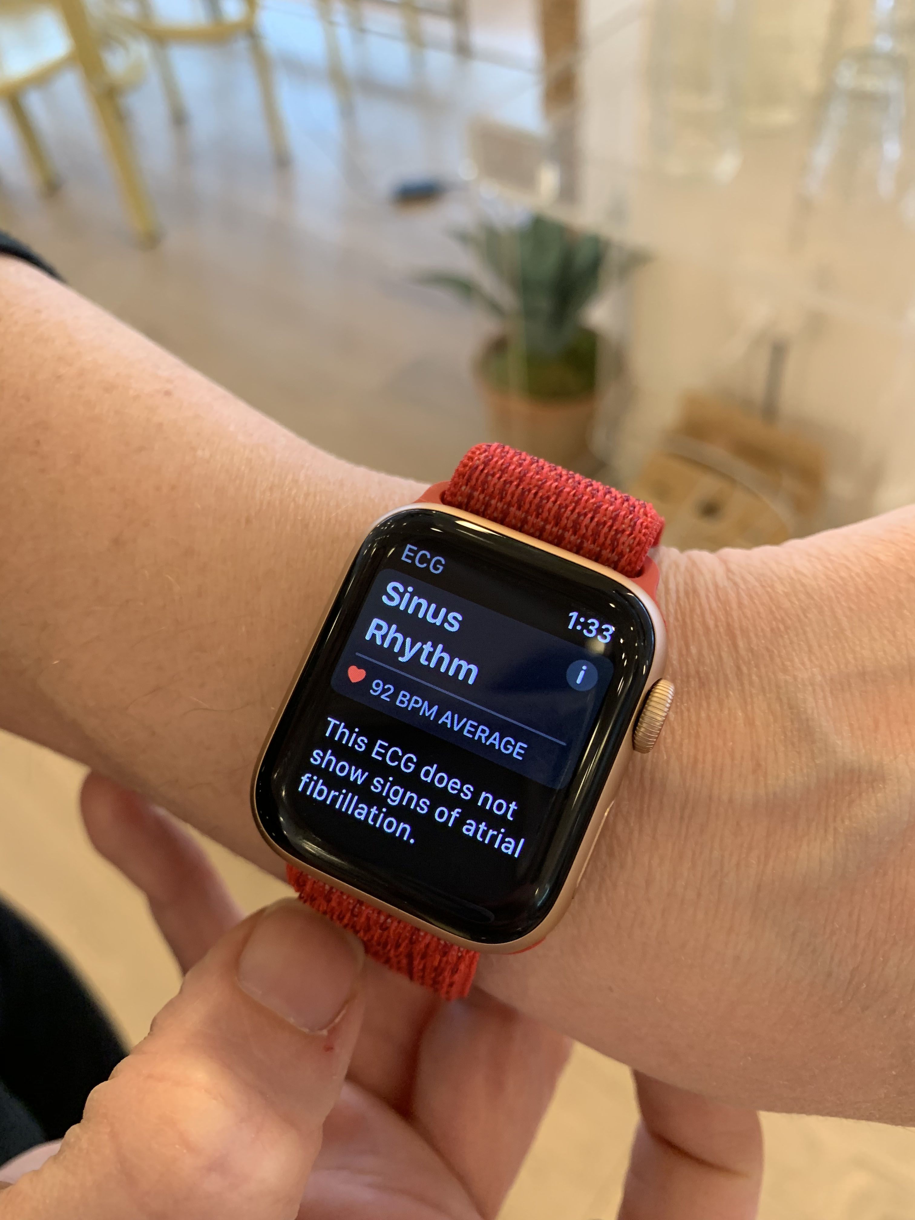 The Apple Watch S Ekg Update Is Here Apple Watch Ecg Review