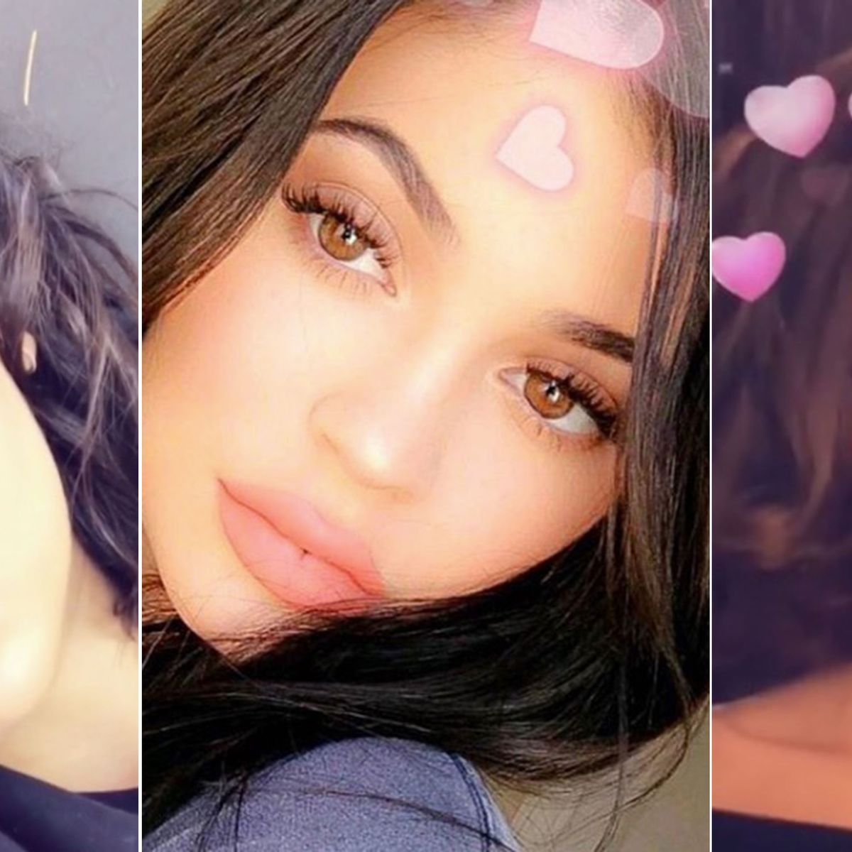 Millennials are getting plastic surgery to look like Snapchat filters
