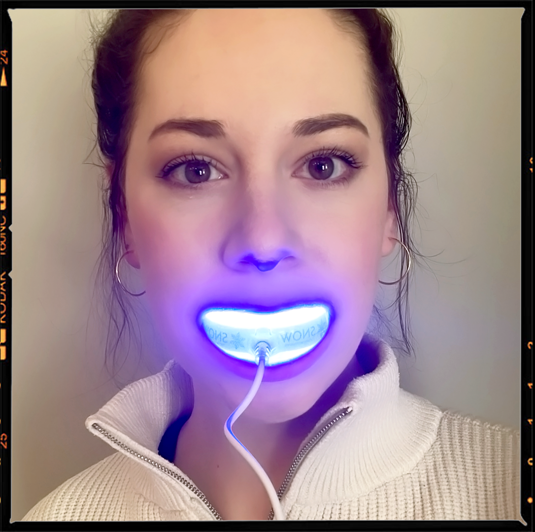 I Tested the Viral Teeth-Whitening Kit From IG—and I Have *Thoughts*