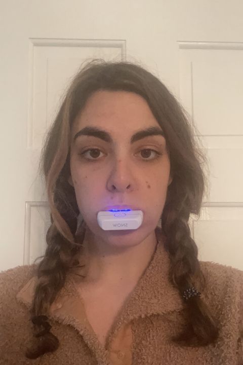 gh freelancer marielle marlys tries the new 21 day snow teeth whitening kit, as pictured here in her mouth