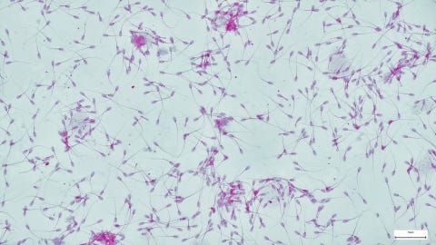 sperm cells or spermatozoa, immunofluorescent photomicrograph, organs samples, histological examination, histopathology on the microscope