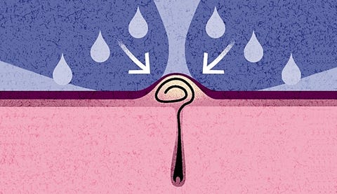 3 Ways To Safely Remove Ingrown Hairs