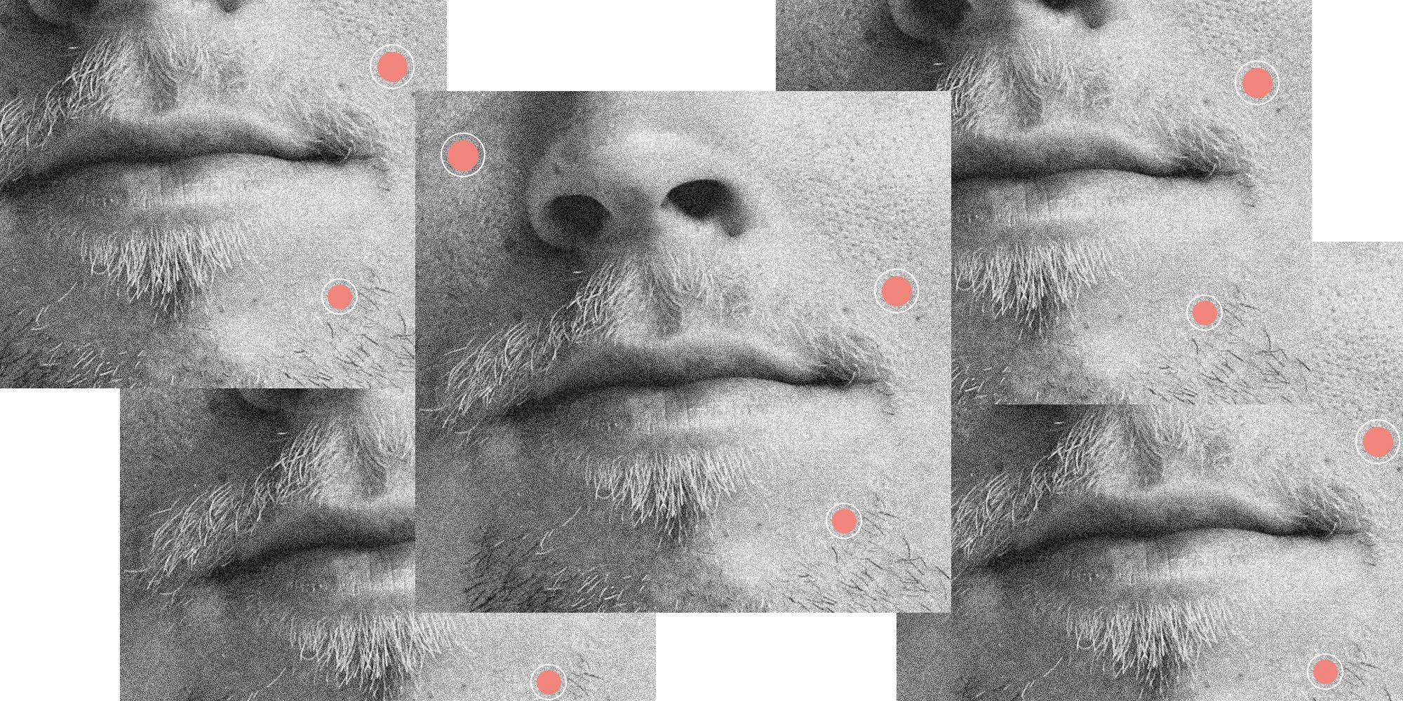 How To Treat Stress Acne And Breakouts For Men