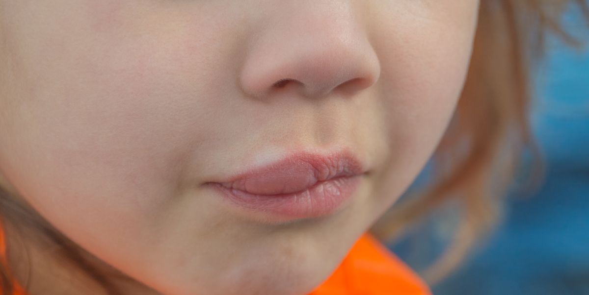 Causes Of Itchy And Swollen Lips Lips Makeupview.
