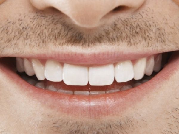 moe Onrecht Voorafgaan Tanden bleken: doen of niet?