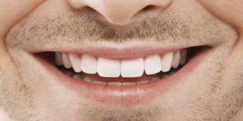 Effectief Nominaal Tentakel Tanden bleken: doen of niet?