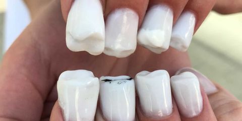teeth nail art