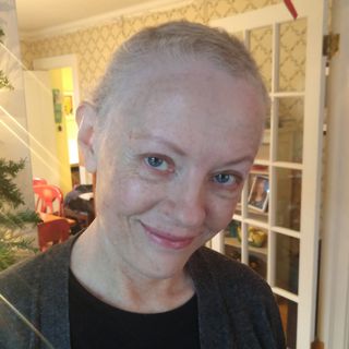teri cettina after losing hair to chemotherapy