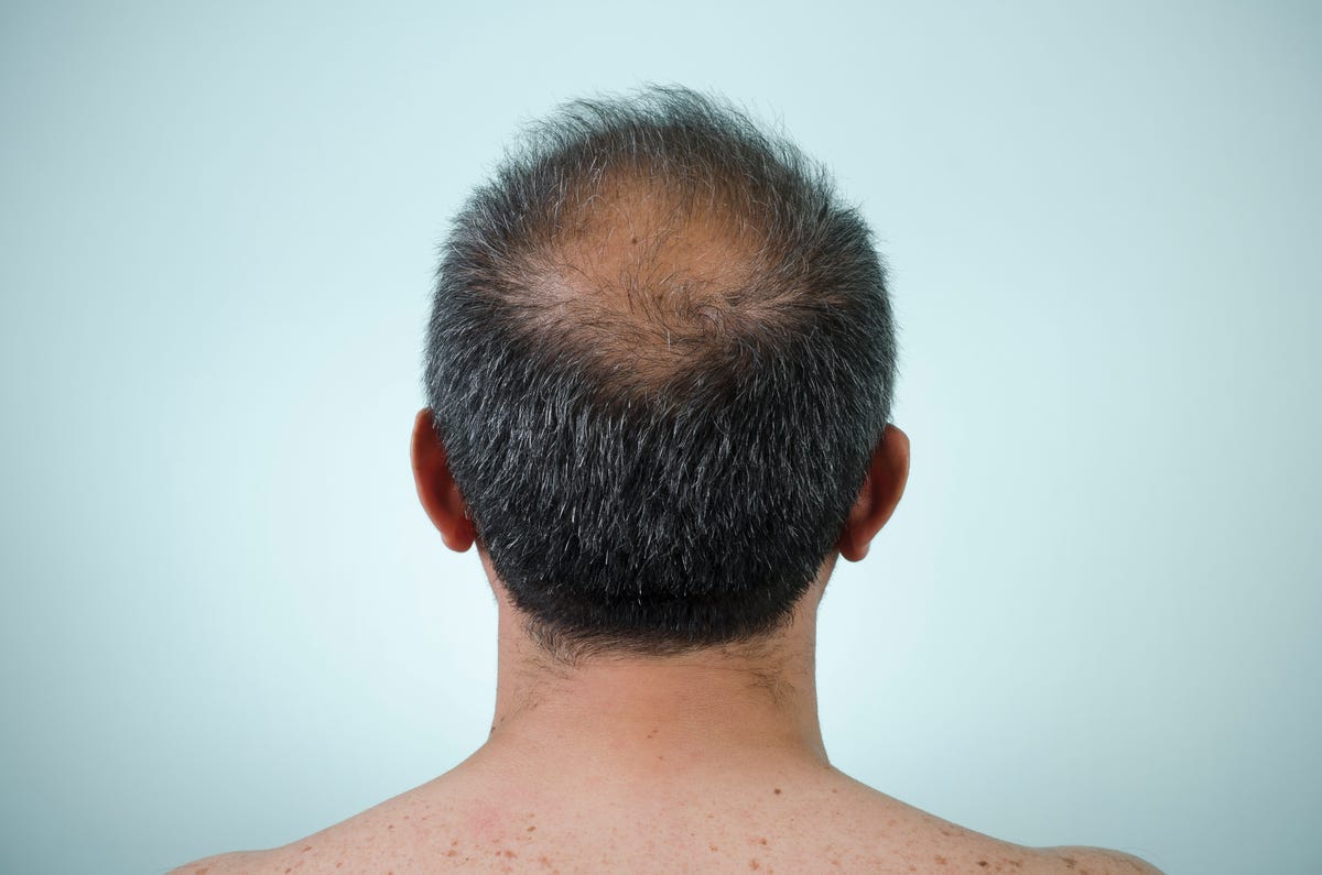 Thicken Your Hair: 11 Clever Hair Thickening Tips