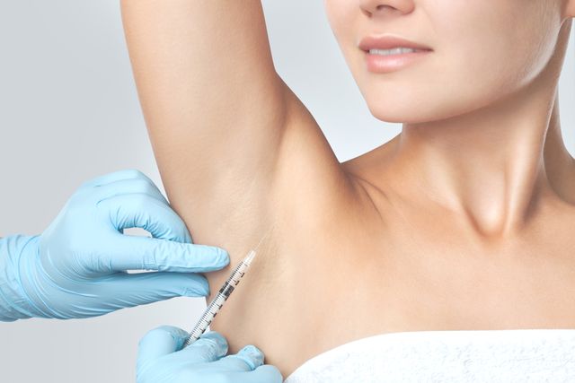 the doctor makes intramuscular injections of botulinum toxin in the underarm area against hyperhidrosis cosmetology skin care
