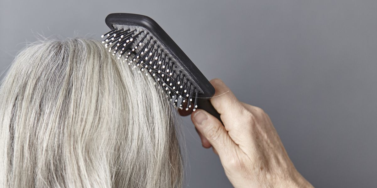 Thinning hair: Everything you need to know about losing your hair