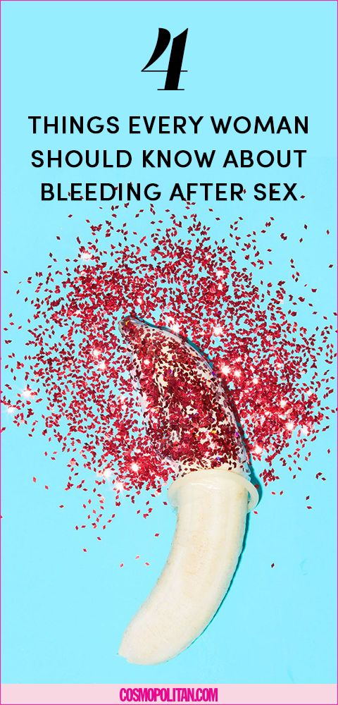Is It Normal To Bleed After Sex 1663