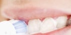 9 Weird Reasons Your Gums Are Bleeding