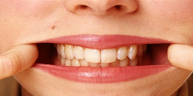 5 Surprising Ways You're Seriously Hurting Your Teeth