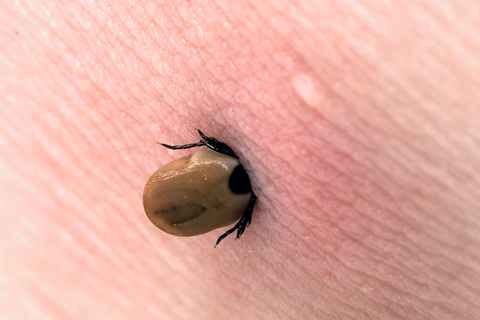 How to get rid of sea ticks on a person Tick Bite Pictures Symptoms What Does A Tick Bite Look Like