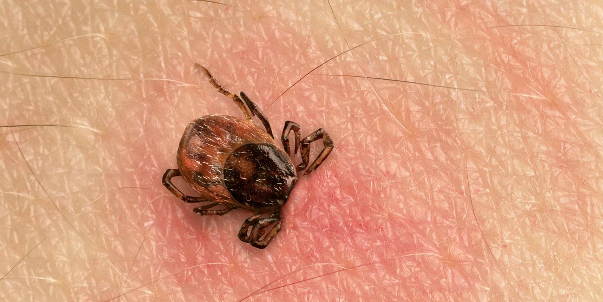 How To Remove A Tick The Right Way According Doctors - How To Get Rid Of Ticks In Yard Diy
