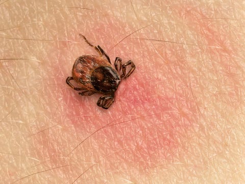 Tick Bite Pictures Symptoms What Does A Tick Bite Look Like