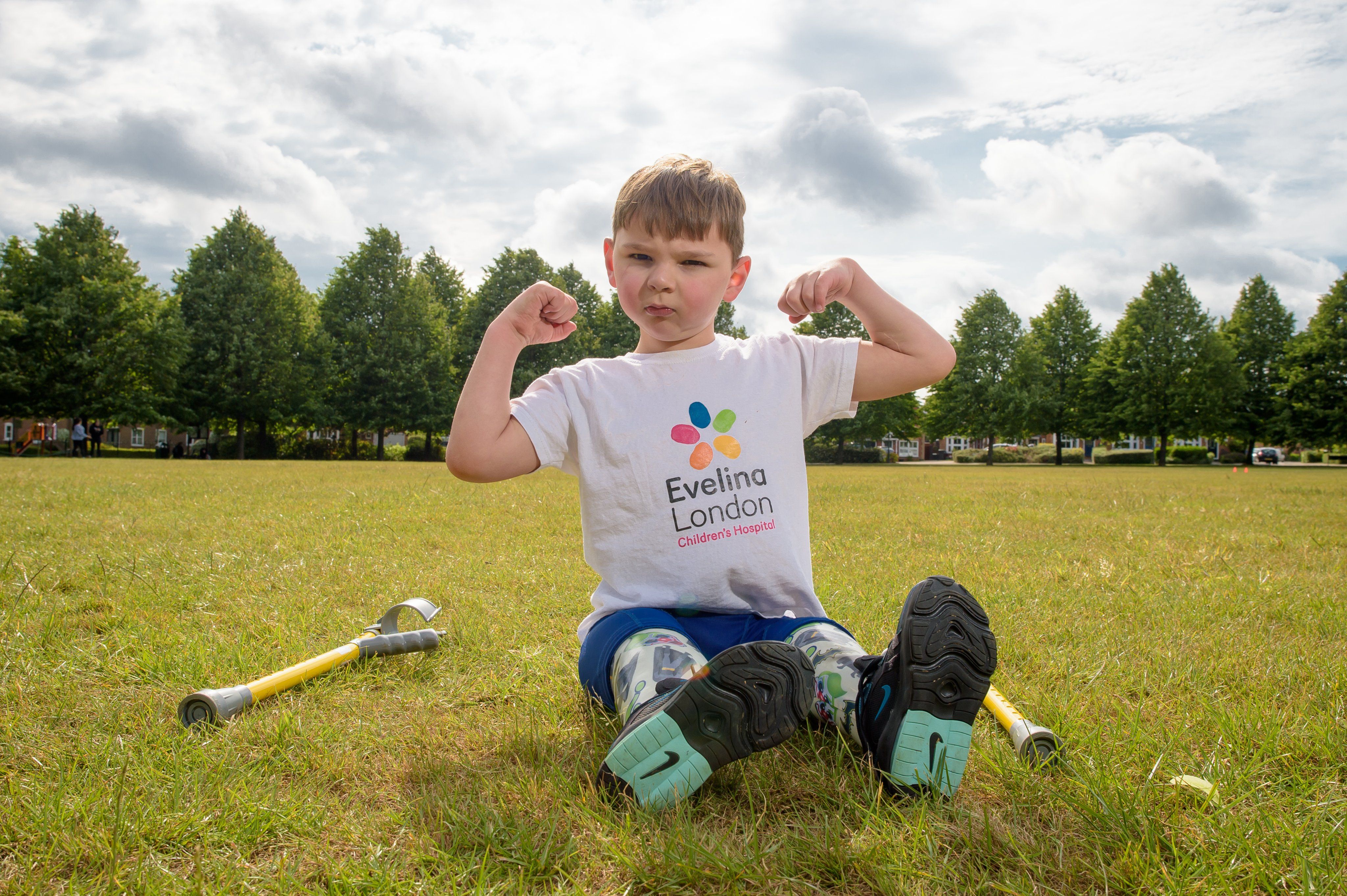 A 5-year-old boy who had both legs amputated has raised £1 million ...