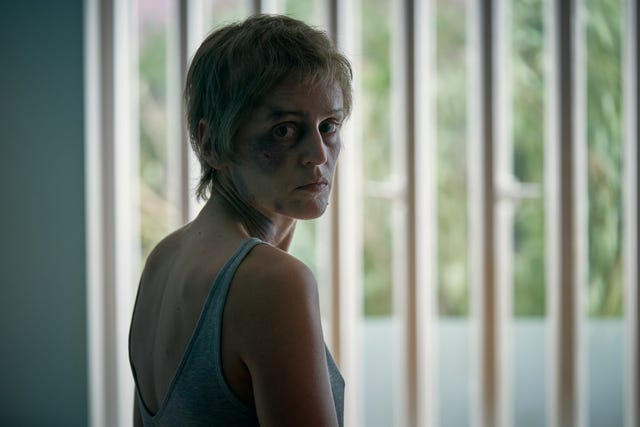 Too Close's Denise Gough on her shocking transformation