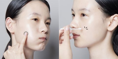大人ニキビの原因と治す方法を美容皮膚科医が指南 洗顔方法やおすすめスキンケアアイテムも紹介