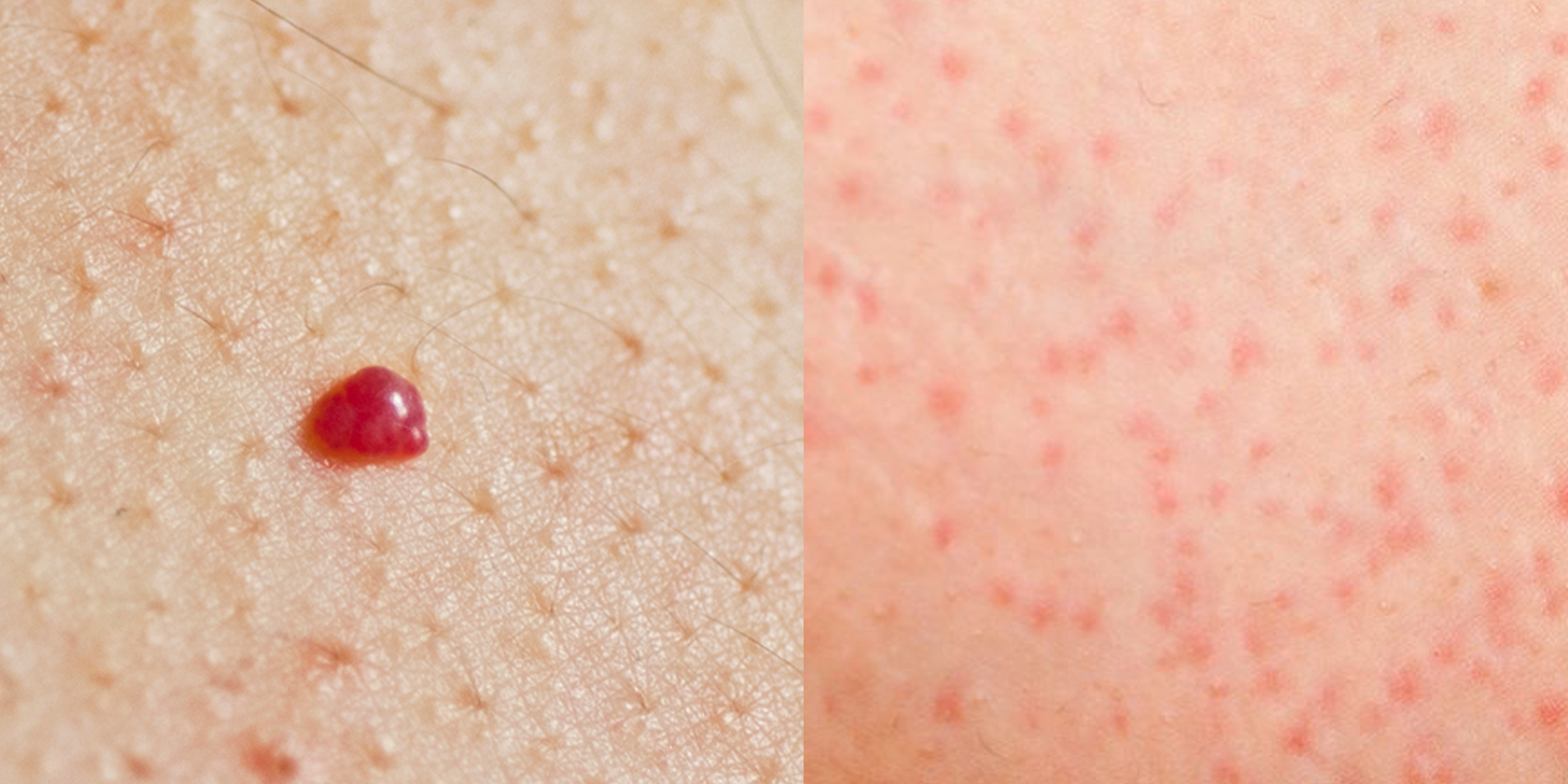 red pinpoint spots under your skin
