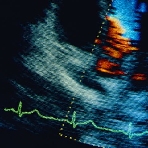 Ultrasound scans are images of the internal organs created from sound waves.