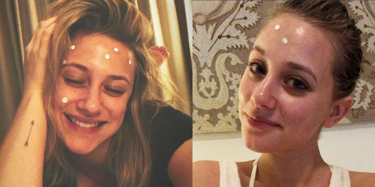 Lili Reinhart Shows Off Cystic Acne - Lili Reinhart Acne