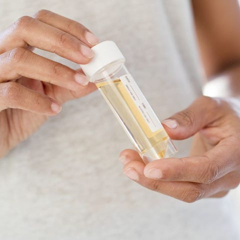 尿が臭くなる食べ物と7つの原因ー ツーンと鼻につく尿の悪臭から分かる身体の健康状態 尿が臭くなる食べ物と7つの原因ー ツーンと鼻につく尿の悪臭から分かる身体の健康状態