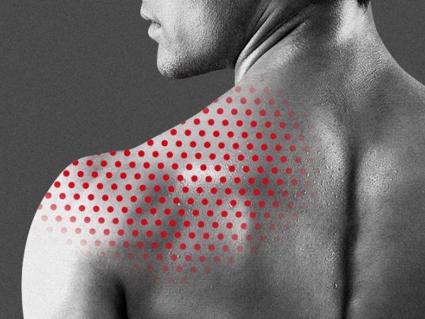 Genre Druif Permanent Waarom die bultjes op je rug waarschijnlijk geen acne is