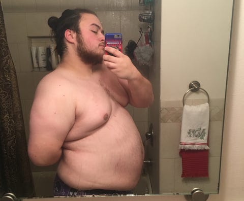 weight loss surgery weight loss surgery