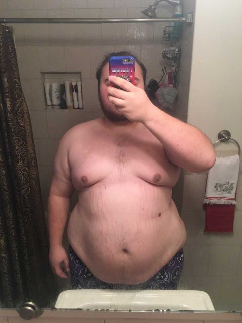 weight loss surgery weight loss surgery