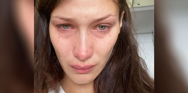 Bella Hadid Opens Up About Her Anxiety And Shares Crying Selfies In An Emotional IG