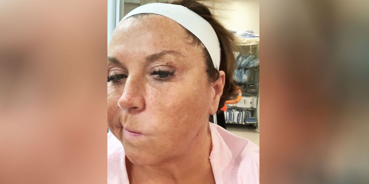 Abby Lee Miller Shows Freckles In Rare No Makeup Instagram Selfies