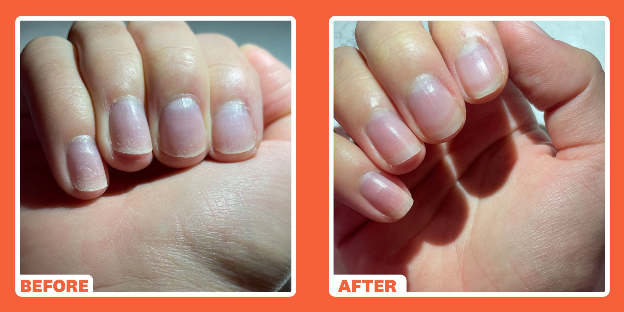 'I Tried Dr. Pawpaw Original Balm And It Transformed My Dry, Scarred Nails'