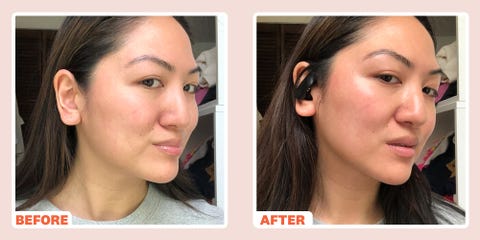 microcurrent face lift microcurrent face lift