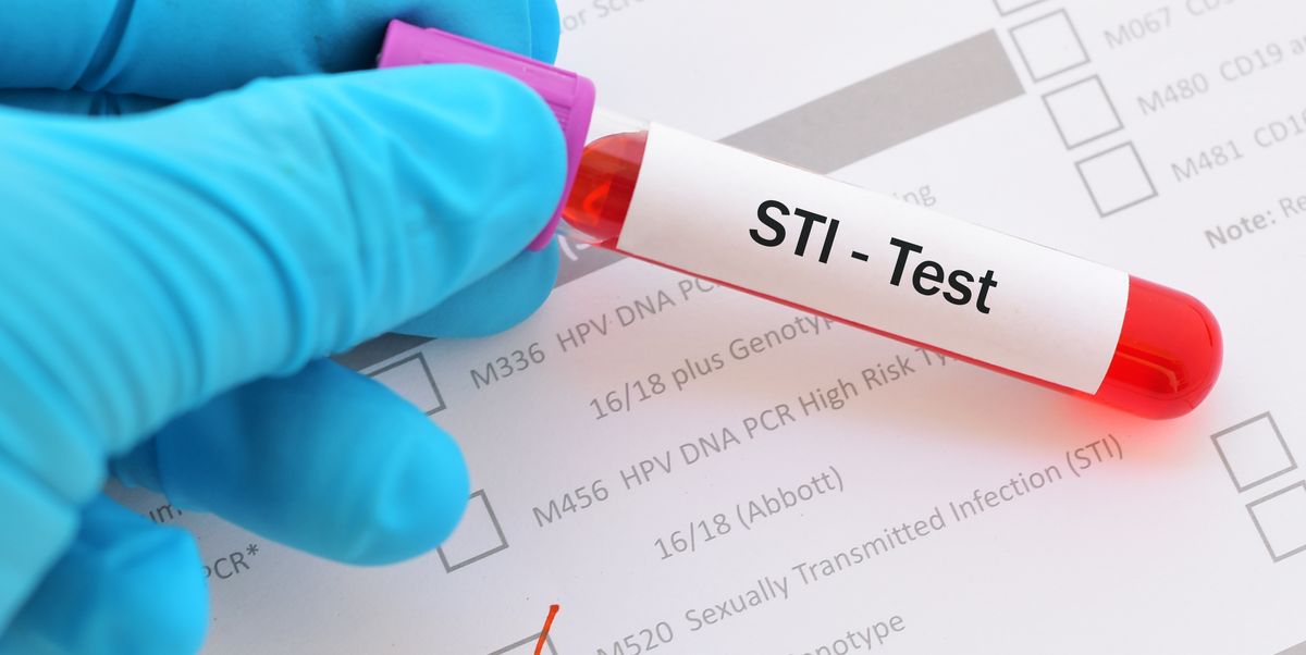 Sexual Health Clinic Sti Testing What To Expect