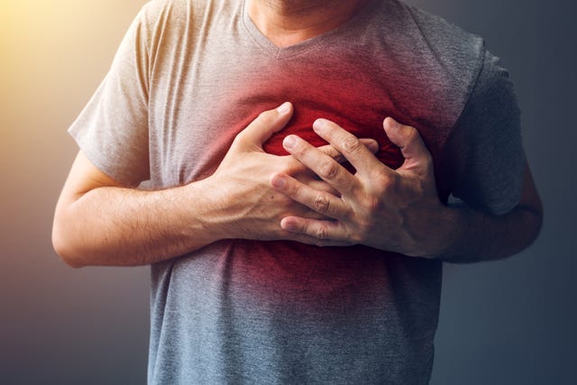 Widowmaker Heart Attack: Signs and Symptoms, Treatment, and Prevention