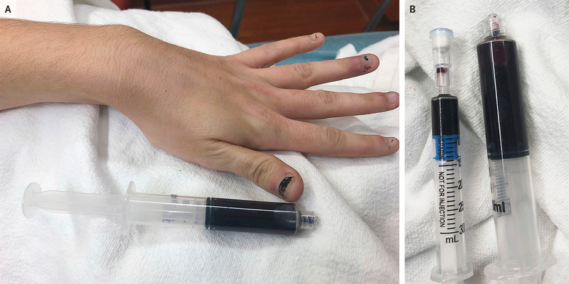 This Woman's Toothache Medication Actually Turned Her Blood Blue