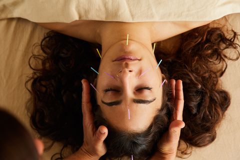 woman having an acupuncture and reiki treatment on her face
