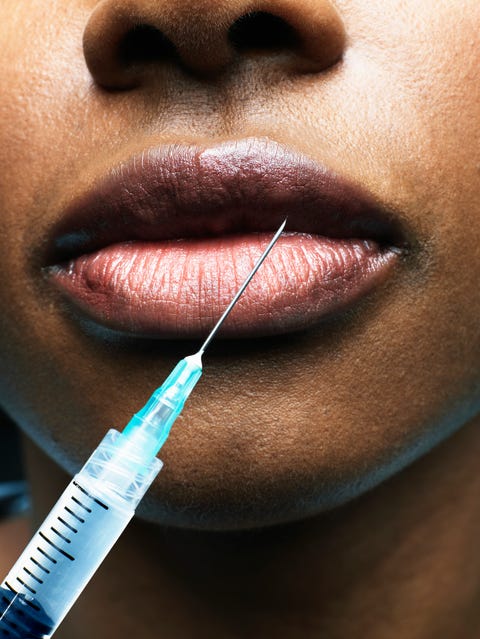 woman receiving injection in lip