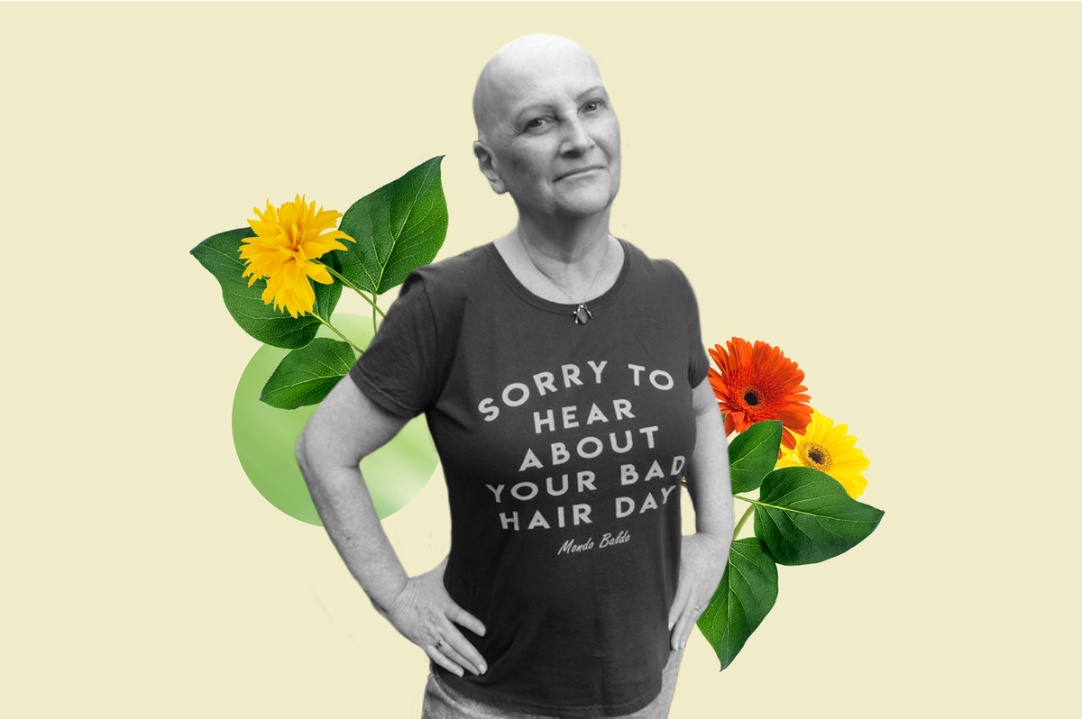 One Woman with Alopecia Opens Up About Deciding to Go Bald One Woman with Alopecia Opens Up About Deciding to Go Bald