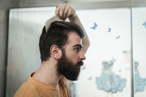 Receding Hairline How To Fix It