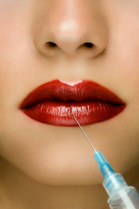 Young woman receiving injection in lip, close-up