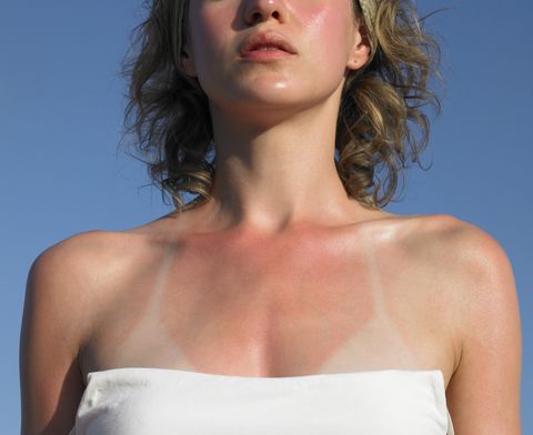 young woman with sunburn tanlines, mid section