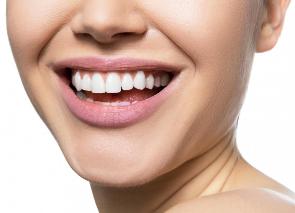 drinken fysiek efficiënt Zelf tanden bleken? Dit is de makkelijkste manier (die écht werkt)