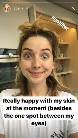 Zoella Looks Gorgeous In Totally Make Up Free Selfie 