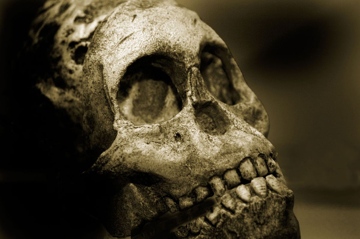 Tandslijtage als gevolg van het kauwen op voedsel zorgde er gedurende een groot deel van de ontwikkelingsgeschiedenis van diverse mensensoorten voor dat de tanden en de kaak goed op elkaar aansloten zoals is te zien aan de schedel van deze mannelijke neanderthaler
